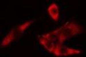 ABIN6275087 staining LOVO cells by IF/ICC. (HECW2 antibody  (Internal Region))