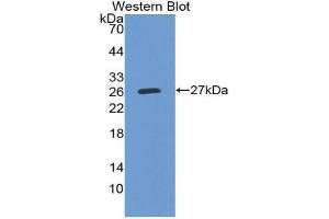 Western blot analysis of the recombinant protein. (Prekallikrein antibody  (AA 156-364))