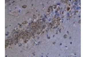 Formalin-fixed and paraffin embedded human spleen labeled with Anti-CXCL9/MIG Polyclonal Antibody, Unconjugated (ABIN741930) at 1:200 followed by conjugation to the secondary antibody and DAB staining. (CXCL9 antibody  (AA 23-125))