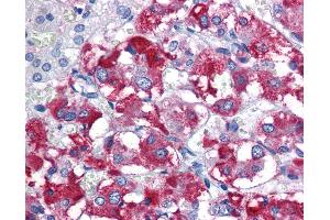 Anti-PARK2 antibody IHC of human adrenal. (Parkin antibody  (AA 311-360))