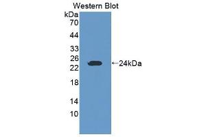 Western blot analysis of the recombinant protein. (GZMK antibody  (AA 44-227))