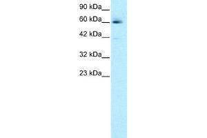 Western Blotting (WB) image for anti-Hematopoietic Cell-Specific Lyn Substrate 1 (HCLS1) (N-Term) antibody (ABIN2777503)