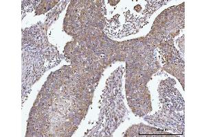 IHC analysis of AGPS using anti-AGPS antibody (ABIN7600146).