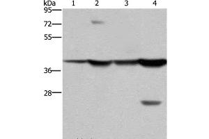 Western Blot analysis of Mouse stomach and Human fetal liver tissue, MCF-7 cell and Mouse liver tissue using FBP1 Polyclonal Antibody at dilution of 1:850 (FBP1 antibody)