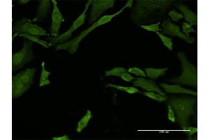Immunofluorescence of monoclonal antibody to TNFRSF21 on HeLa cell.