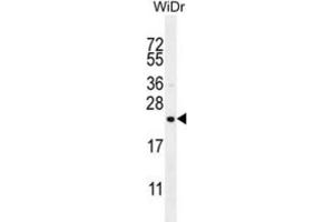 Western Blotting (WB) image for anti-Family with Sequence Similarity 237 Member A (FAM237A) antibody (ABIN3004576) (FAM237A antibody)