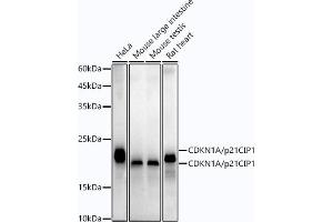 Western Blotting (WB) image for anti-Cyclin-Dependent Kinase Inhibitor 1A (p21, Cip1) (CDKN1A) antibody (ABIN7266599)