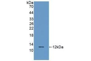 Detection of Recombinant RANTES, Porcine using Polyclonal Antibody to Regulated On Activation In Normal T-Cell Expressed And Secreted (RANTES) (CCL5 antibody  (AA 24-91))