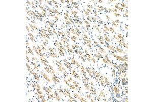 Immunohistochemistry analysis of paraffin-embedded mouse fetal rat using GBA (ABIN7074062) at dilution of 1: 2000