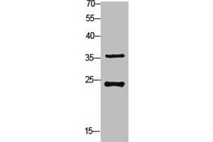 Western Blot analysis of customer's (cat sample) using Ribosomal Protein S4X Polyclonal Antibody (RPS4X antibody  (Internal Region))
