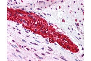 Anti-GRM5 / MGLUR5 antibody IHC of human colon, myenteric plexus.