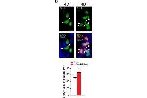 Immunofluorescence (Paraffin-embedded Sections) (IF (p)) image for anti-Red Fluorescent Protein (RFP) antibody (ABIN1607680)
