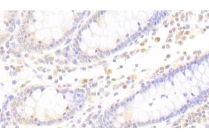 Detection of APBB1IP in Human Colon Tissue using Polyclonal Antibody to Amyloid Beta Precursor Protein Binding B1 Interacting Protein (APBB1IP) (Amyloid beta (A4) Precursor Protein-Binding, Family B, Member 1 Interacting Protein (APBB1IP) (AA 188-421) antibody)