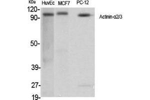 Western Blot (WB) analysis of specific cells using Actinin-alpha2/3 Polyclonal Antibody. (ACTN2/3 antibody  (N-Term))