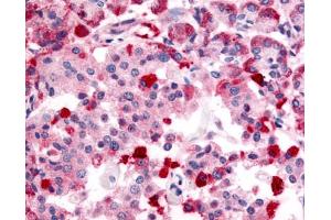 Anti-TRPM4 antibody IHC of human pancreas. (TRPM4 antibody  (Internal Region))