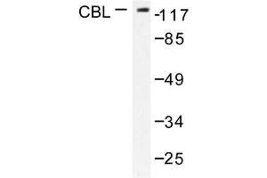Image no. 1 for anti-Cas-Br-M (Murine) Ecotropic Retroviral Transforming Sequence (CBL) antibody (ABIN271926) (CBL antibody)