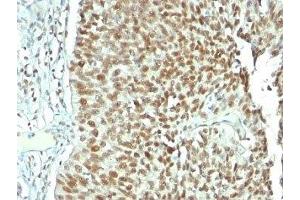 Image no. 5 for anti-Nucleolin (NCL) antibody (ABIN3025707)