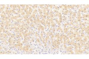 Detection of PSA in Human Liver Tissue using Polyclonal Antibody to Puromycin Sensitive Aminopeptidase (PSA) (NPEPPS antibody  (AA 584-793))