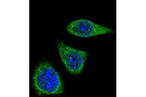 Confocal iunofluorescent analysis of P7 Antibody (Center) (ABIN390152 and ABIN2840651) with 293 cell followed by Alexa Fluor® 488-conjugated goat anti-rabbit lgG (green). (MMP7 antibody  (AA 117-146))