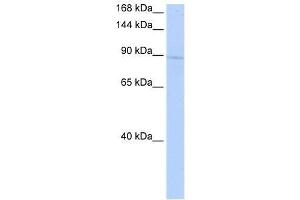 Western Blot showing KIF20A antibody used at a concentration of 1 ug/ml against 721_B Cell Lysate (KIF20A antibody  (Middle Region))