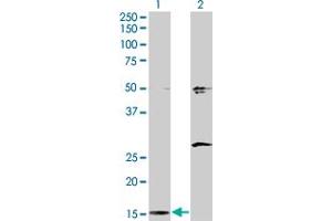 Western Blot analysis of AP2S1 expression in transfected 293T cell line by AP2S1 monoclonal antibody (M01), clone 3E4.