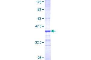 SLC1A2 Protein (AA 160-239) (GST tag)