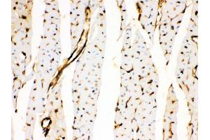 Anti- Annexin A3 Picoband antibody, IHC(P) IHC(P): Rat Cardiac Muscle Tissue (Annexin A3 antibody  (Middle Region))