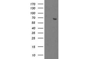 HEK293T cells were transfected with the pCMV6-ENTRY control (Left lane) or pCMV6-ENTRY OGFOD1 (Right lane) cDNA for 48 hrs and lysed. (OGFOD1 antibody)