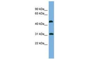 Image no. 1 for anti-CTD (Carboxy-terminal Domain, RNA Polymerase II, Polypeptide A) Small Phosphatase 2 (CTDSP2) (N-Term) antibody (ABIN6743624) (CTDSP2 antibody  (N-Term))