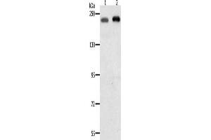 Western Blotting (WB) image for anti-SWI/SNF Related, Matrix Associated, Actin Dependent Regulator of Chromatin, Subfamily A, Member 4 (SMARCA4) antibody (ABIN2431119) (SMARCA4 antibody)