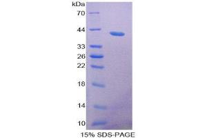 SDS-PAGE (SDS) image for Resistin Like beta (RETNLB) (AA 24-105) protein (His tag,GST tag) (ABIN2123554)