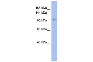 WB Suggested Anti-DDX26B Antibody Titration:  0. (DDX26B antibody  (N-Term))