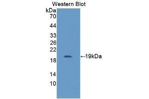 Detection of Recombinant IL11Ra, Mouse using Polyclonal Antibody to Interleukin 11 Receptor Alpha (IL11Ra) (IL11RA antibody  (AA 59-217))
