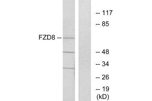 Western blot analysis of extracts from Jurkat cells, using FZD8 antibody. (FZD8 antibody  (C-Term))