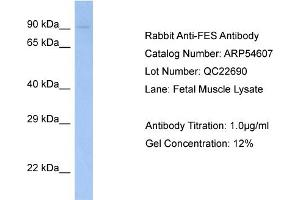 Western Blotting (WB) image for anti-Feline Sarcoma Oncogene (FES) (N-Term) antibody (ABIN970692) (FES antibody  (N-Term))
