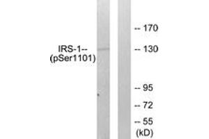 Western blot analysis of extracts from COS7 cells treated with Calyculin A 50ng/ml 30', using IRS-1 (Phospho-Ser1101) Antibody. (IRS1 antibody  (pSer1101))