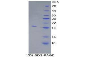 SDS-PAGE (SDS) image for Peroxiredoxin 5 (PRDX5) (AA 49-210) protein (His tag) (ABIN1981184)