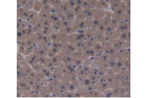Immunohistochemistry (Paraffin-embedded Sections) (IHC (p)) image for anti-beta-2-Microglobulin (B2M) (AA 22-119) antibody (ABIN5662312)