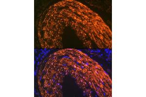 Immunofluorescence analysis of mouse large intestine using Calponin Rabbit mAb (ABIN1678670, ABIN3018018, ABIN3018019 and ABIN7101568) at dilution of 1:100 (40x lens). (CNN1 antibody)