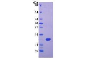 Image no. 1 for Interferon gamma (IFNG) (AA 24-166) (Active) protein (His tag) (ABIN6239736) (Interferon gamma Protein (IFNG) (AA 24-166) (His tag))