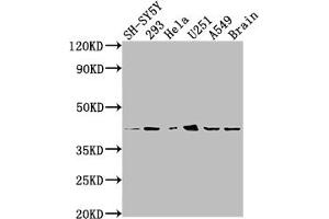 Western Blot Positive WB detected in: SH-SY5Y whole cell lysate, 293 whole cell lysate, Hela whole cell lysate, U251 whole cell lysate, A549 whole cell lysate, Mouse brain tissue All lanes: OPRD1 antibody at 1:2000 Secondary Goat polyclonal to rabbit IgG at 1/50000 dilution Predicted band size: 41 kDa Observed band size: 41 kDa