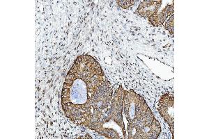 IHC analysis of GPCR RDC1/CXCR-7/ACKR3 using anti-GPCR RDC1/CXCR-7/ACKR3 antibody (ABIN7602889).