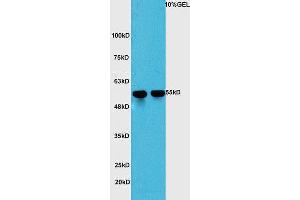 L1 mouse liver lysates L2 mouse lung lysates probed with Anti-YAP1 Polyclonal Antibody, Unconjugated  at 1:5000 for 90 min at 37˚C. (YAP1 antibody  (AA 131-330))