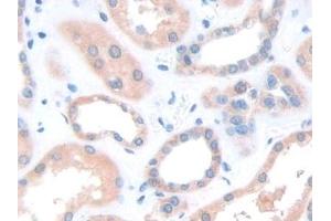 Detection of PANX1 in Human Kidney Tissue using Polyclonal Antibody to Pannexin 1 (PANX1) (PANX1 antibody  (AA 228-411))