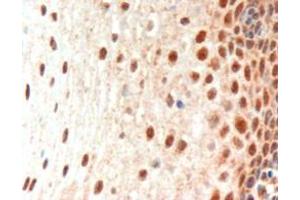 ABIN185216 (3µg/ml) staining of paraffin embedded Human Oesophagus. (Paired Box 3 antibody  (N-Term))