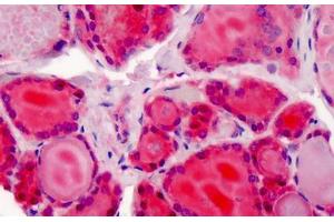 Human Thyroid: Formalin-Fixed, Paraffin-Embedded (FFPE) (XPO1 antibody  (AA 390-408))