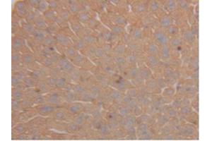 IHC-P analysis of Mouse Liver Tissue, with DAB staining. (Cytokeratin 18 antibody  (AA 1-423))