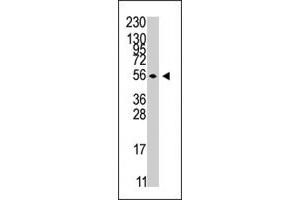 The STK38 polyclonal antibody  is used in Western blot to detect STK38 in Jurkat cell line lysates . (STK38 antibody  (C-Term))