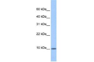 WB Suggested Anti-C20orf141 Antibody Titration: 0. (C20orf141 antibody  (Middle Region))