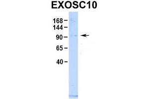 Host:  Rabbit  Target Name:  EXOSC10  Sample Type:  Human 293T  Antibody Dilution:  1. (EXOSC10 antibody  (C-Term))